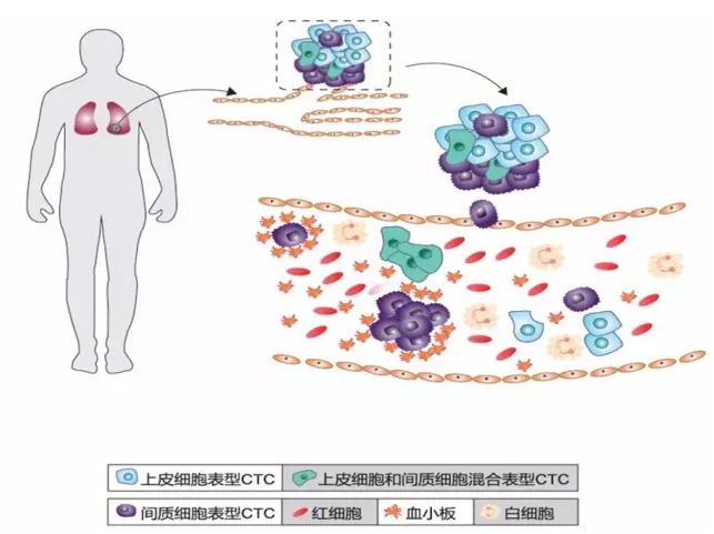 CTC循環(huán)腫瘤細(xì)胞的分類 CTC循環(huán)腫瘤細(xì)胞的分類