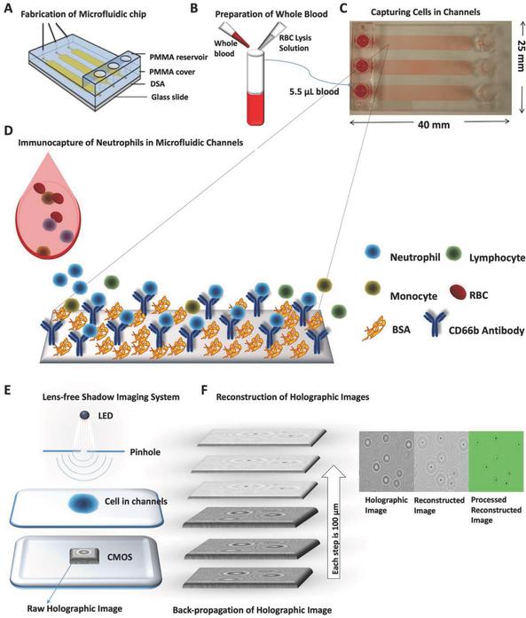 監(jiān)控血液中嗜中性粒細胞數量的新方法 監(jiān)控血液中嗜中性粒細胞數量的新方法