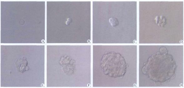 圖4 動態(tài)觀察96孔板培養(yǎng)的單個腫瘤干細胞