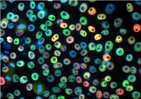 細(xì)胞異質(zhì)性 細(xì)胞異質(zhì)性