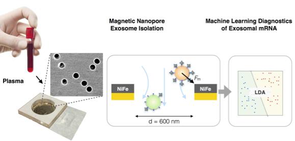 納米流控技術(shù)與機器學(xué)習(xí)相結(jié)合利用外泌體精確診斷胰腺癌 納米流控技術(shù)與機器學(xué)習(xí)相結(jié)合利用外泌體精確診斷胰腺癌