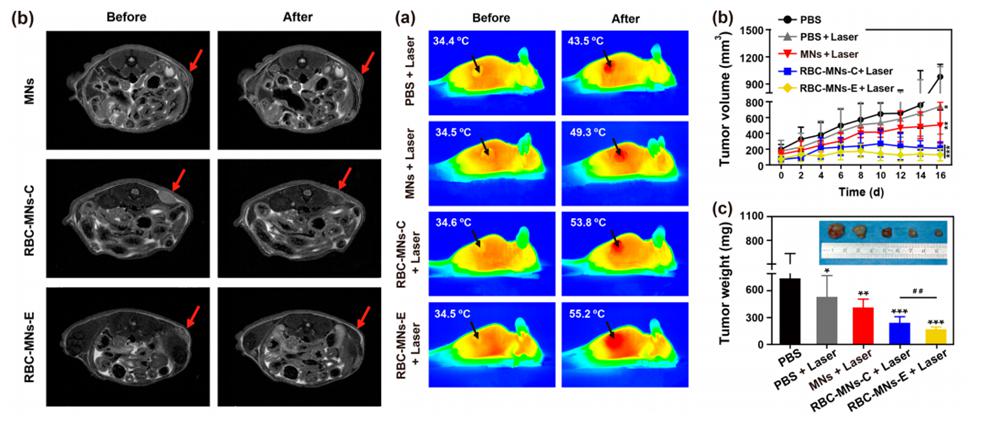電穿孔包膜技術(shù)應(yīng)用于腫瘤MRI成像與光熱治療 電穿孔包膜技術(shù)應(yīng)用于腫瘤MRI成像與光熱治療