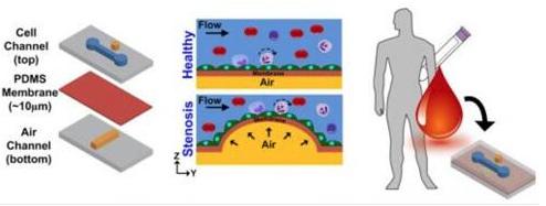 在芯片上實(shí)現(xiàn)動(dòng)脈粥樣硬化的模擬，并在心臟病發(fā)作前評(píng)估血管的狹窄和血液的健康狀況