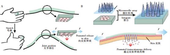 圖2可穿戴式微流控藥物釋放裝置。(A)內(nèi)置藥物的可穿戴式微流控芯片,通過(guò)手指的彎曲完成藥物釋放(B)內(nèi)置藥物的可穿戴芯片與微針陣列結(jié)合