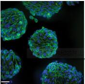 3D細(xì)胞培養(yǎng)微流控芯片