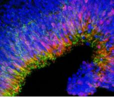 由3D細胞培養(yǎng)產(chǎn)生的新生視網(wǎng)膜 由3D細胞培養(yǎng)產(chǎn)生的新生視網(wǎng)膜