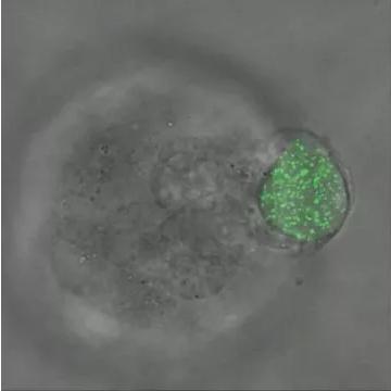 華中科大研發(fā)出測(cè)量三維生物力的新技術(shù),有望用于癌癥早期診斷 華中科大研發(fā)出測(cè)量三維生物力的新技術(shù),有望用于癌癥早期診斷