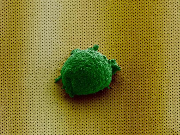 《Small》雜志封面圖片顯示，單個淋巴瘤細(xì)胞孤獨地存在于新型生物傳感器上。