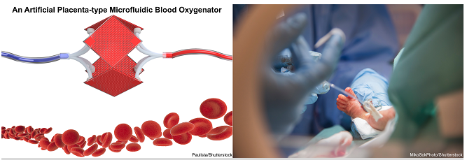 微加工技術(shù)解決早產(chǎn)兒肺功能不全的問題不再是夢 微加工技術(shù)解決早產(chǎn)兒肺功能不全的問題不再是夢