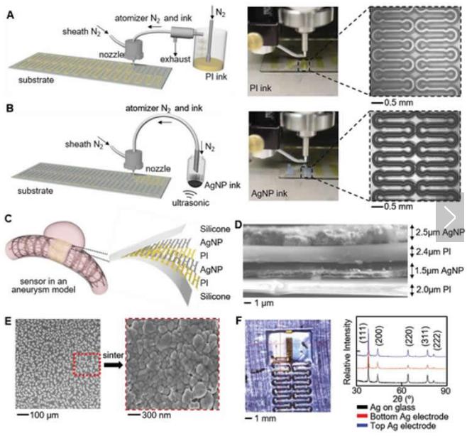 可拉伸的無(wú)線傳感器可以監(jiān)測(cè)腦動(dòng)脈瘤的愈合 可拉伸的無(wú)線傳感器可以監(jiān)測(cè)腦動(dòng)脈瘤的愈合