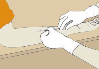 微流控芯片|微流控芯片批量加工